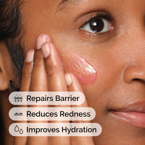 Soothing & Barrier Support Serum Set